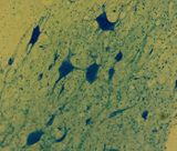 isolated Motor Neurons