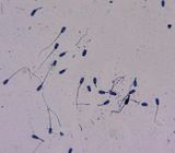 Sperm smear  -Pig-