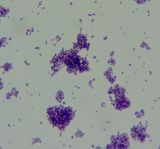 E. coli bacteria  -rod bacilli-