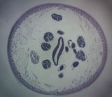 male Ascaris worm section