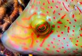 Eye