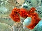 Orangutang Crab On Anemone, Achaeus japonicus