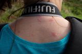 Knockan Crag, the appetite of mosquitoes