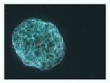 Oyster Nebula Ngc 1501