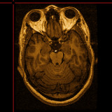 Brain y Eyeballs