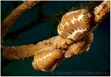 Fingerprint cyphoma.