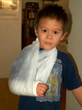 2008-03-19 Olivers broken arm