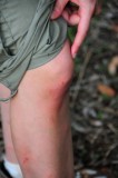 15 Sarah's injuries 2586