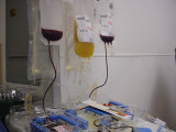 my platelets