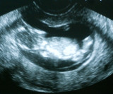 August 6, 2008