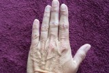 ACA Hand close up thin skin-no 9.jpg