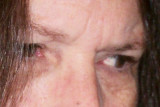 ACA both eyes April 08-no. 11.jpg
