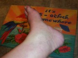 ACA more swelling foot-pic1.jpg