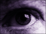 My eye