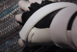Tenosynovitis/ de Quervains disease