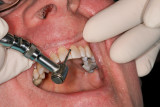 The Dentists Drill