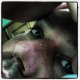 175:366<br>Down