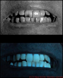 Teeth UV cmp_c.jpg