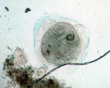 Stentor and rotifers