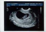 baby-3.JPG