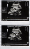 baby-19.jpg