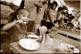 Malnourished children feeding program
