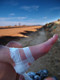 Wrapped Foot