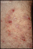 TINEA INCOGNITO_03.jpg