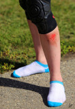 IMG_2988 Loves Longboarding so much her wound is shaped like a heart - Aug 18