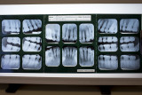 7/31/2013  My dental X-rays