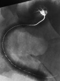 Codiacrinus schultzei, 45 cm along the curve.
