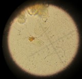 Disciotis venosa 2015-4-14 003 ascospore 23x12.5 microns .JPG