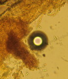 Diaporthe rudis 2015-5-16 003 biseriate ascus with 1-septate guttulate spores - Copy.JPG