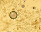 Inocybe tarda 002 spores & cystidia 2015-9-12.JPG