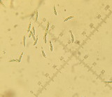 Hymenoscyphus scutula 002 spores 2015-11-3.JPG