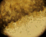 Inocybe tarda 002 cheilocystidia shorter than in I. nitidiuscula 2015-10-25.jpg