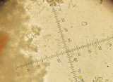 Botryobasidium obtusisporum 003 spores Spalford Warren NR Notts 2015-11-15.JPG