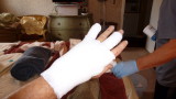 We got pretty good at bandaging. Heres a fresh wrap of my left hand. 