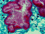 Lichen, Light Field, 800x (cross section)