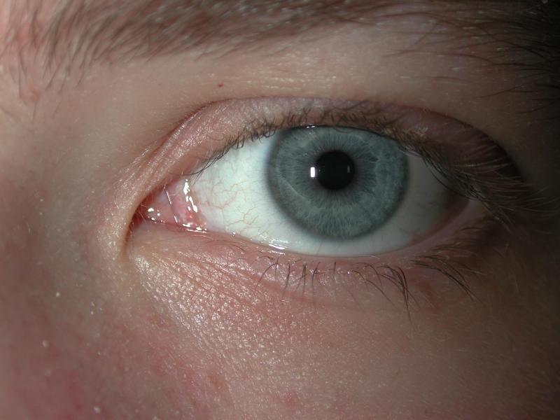 big eye