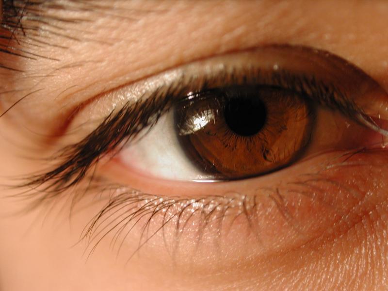 and another big eye..