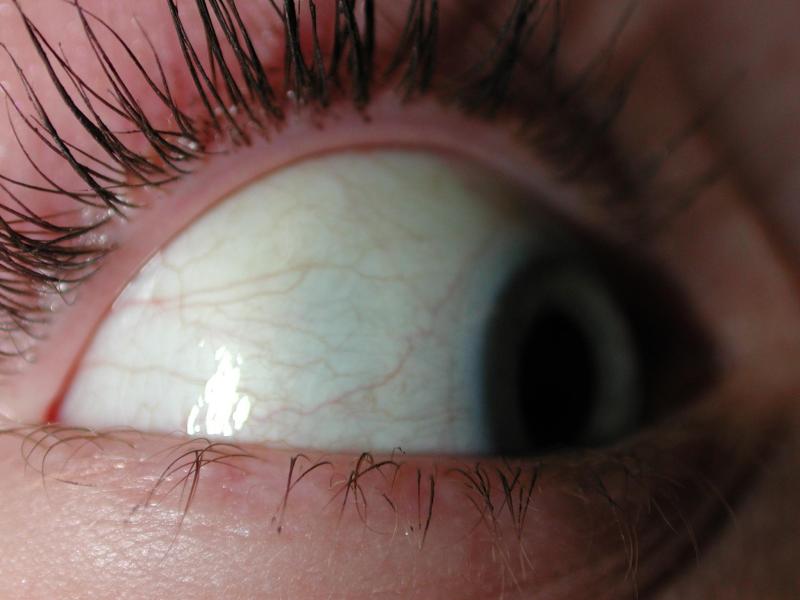 scary eye