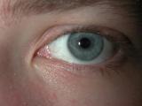 big eye