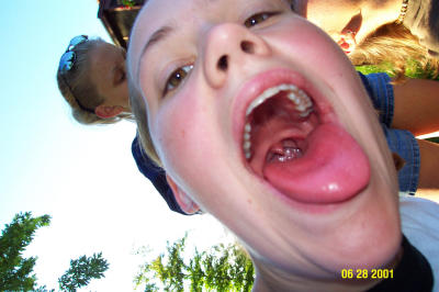 Alex's Grad Party -Sarah's Mouth.JPG