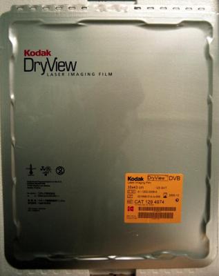 Kodak Laser Imaging Film for Radiotherapy