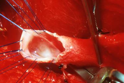 Medical photography