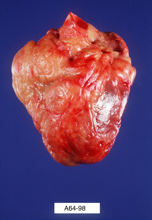 Healthy human heart specimen.