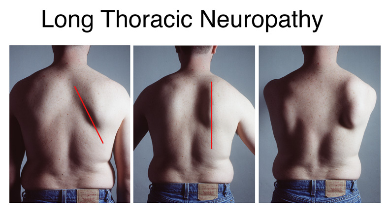 Composite photo of neurological study.