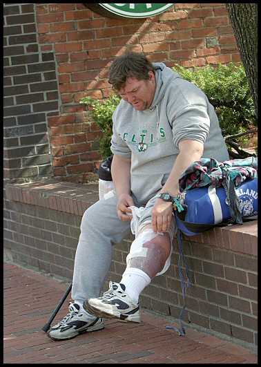 Badleg