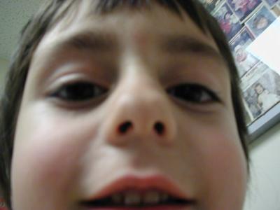 Isaac took this photo of himself while waiting for the doctor...